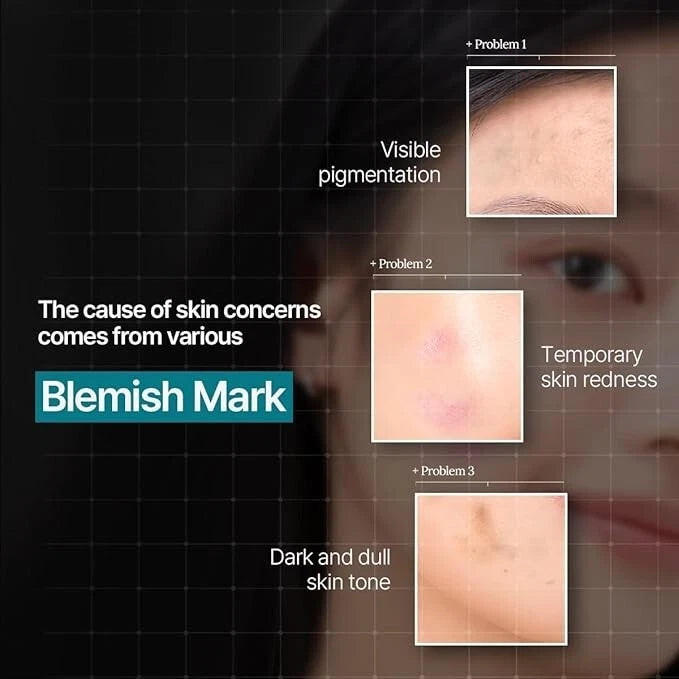 MEDIHEAL Madecassoside Essential Mask Sheet Blemish Repair 24g×11sheets