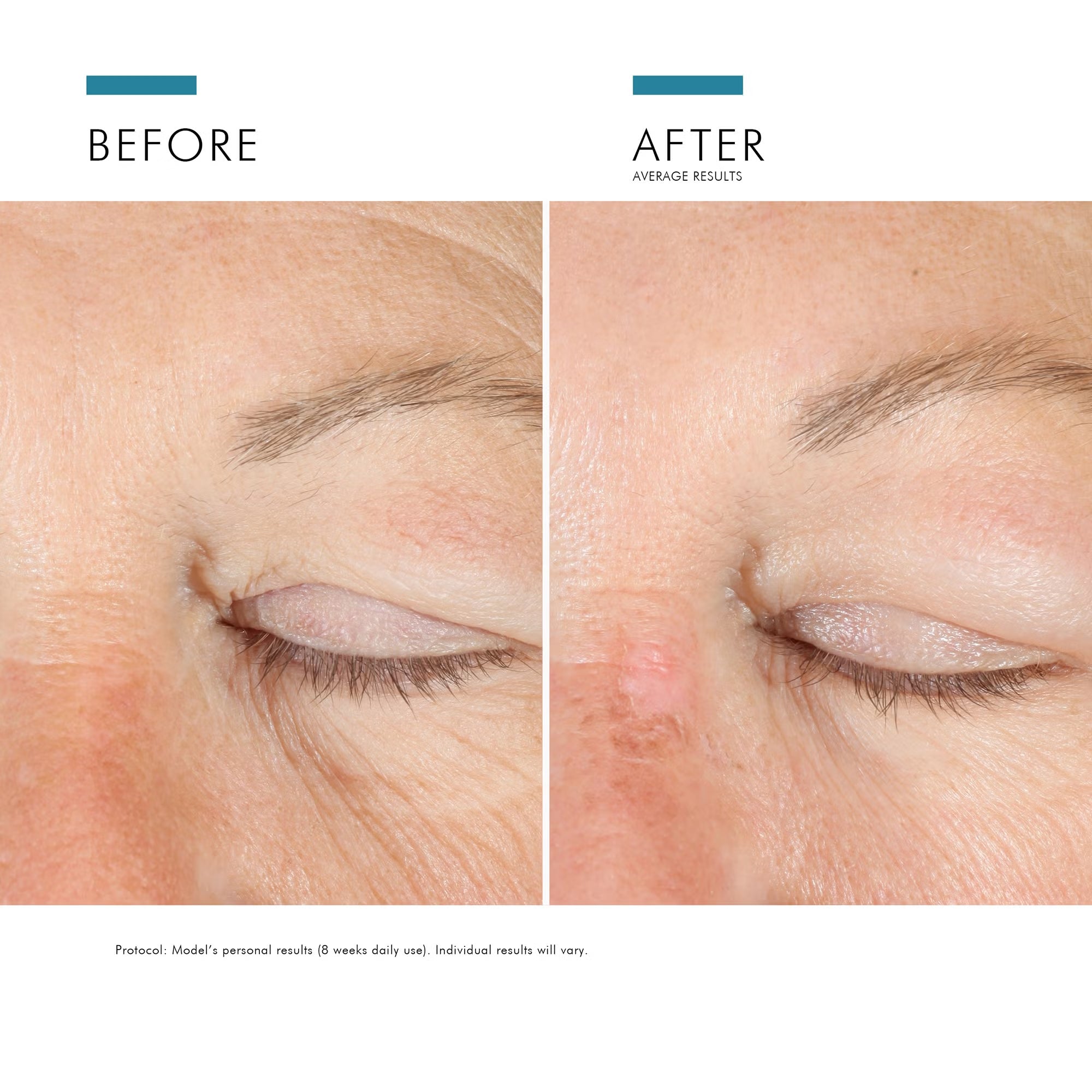 SkinCeuticals A.G.E. Advanced Eye for Dark Circles & Wrinkles 15ml