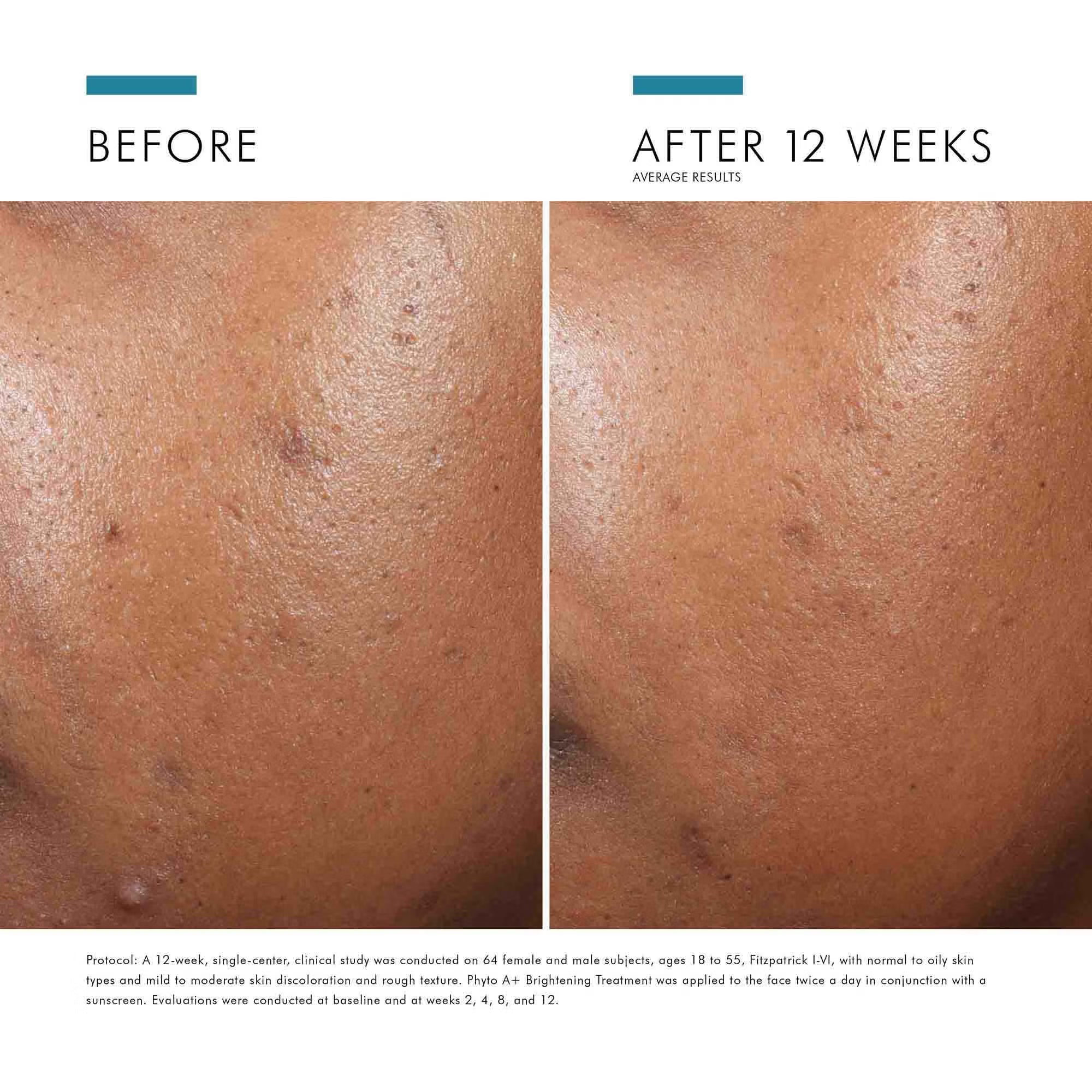 SkinCeuticals Phyto A+ Brightening Treatment Lightweight Moisturizer 30ml