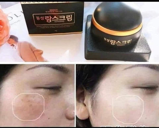 Dongsung Rannce Cream 70g