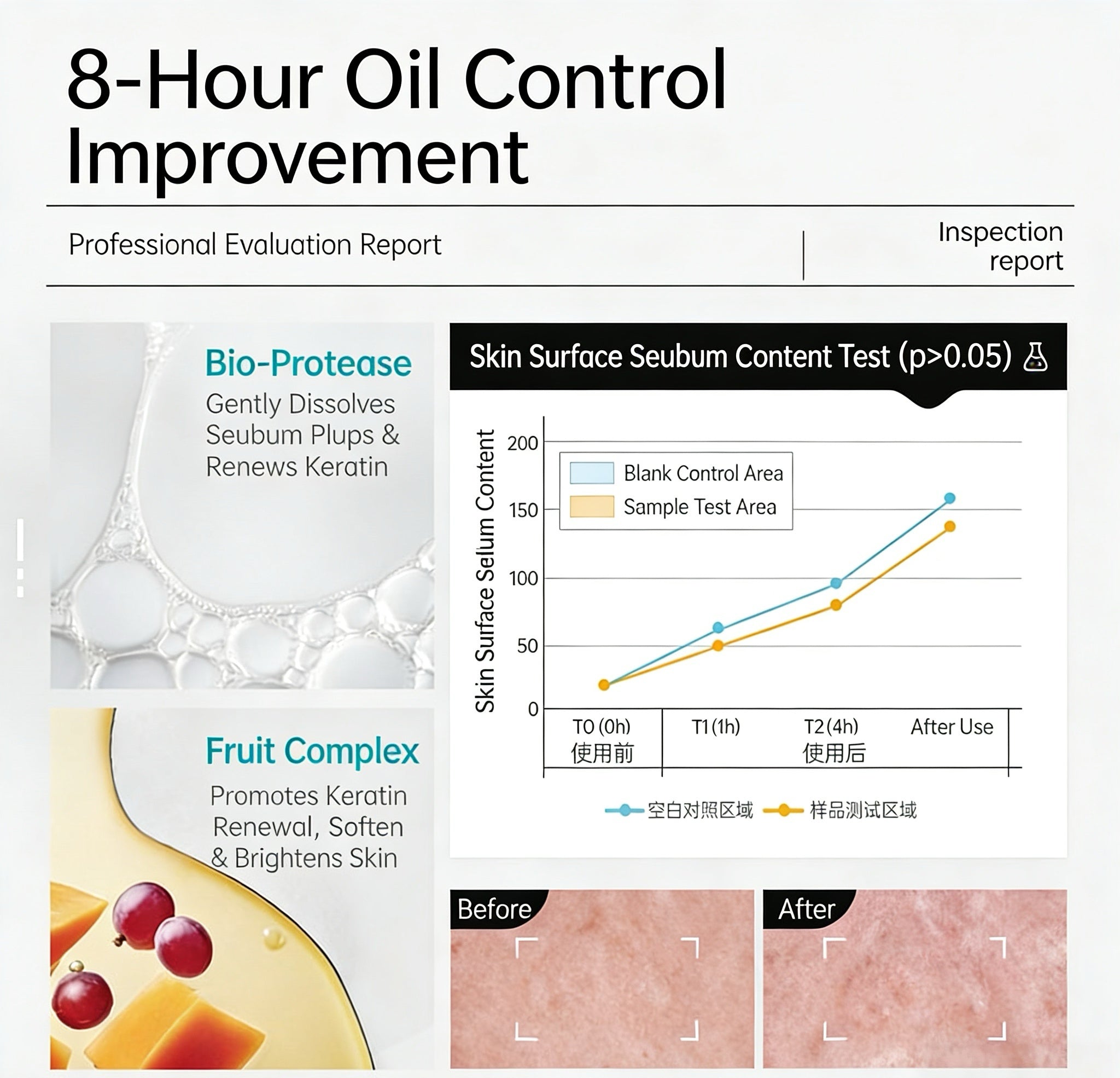 ILSO Blackhead Removal & Pore Care Special Set