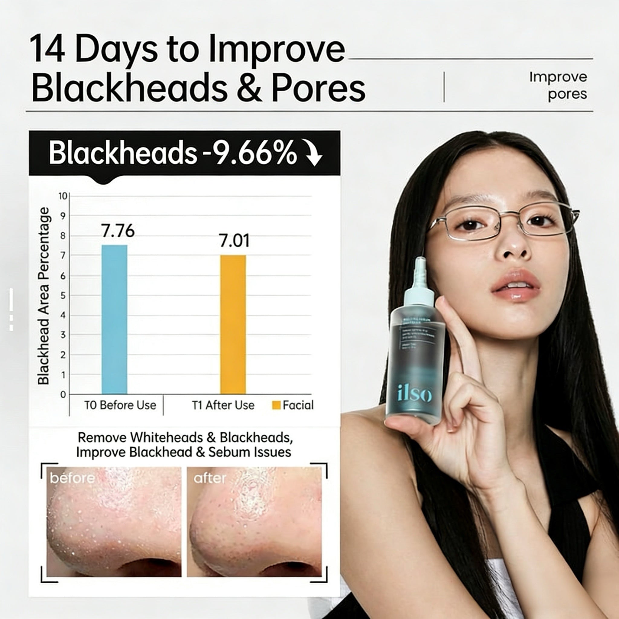 ILSO Blackhead Removal & Pore Care Special Set