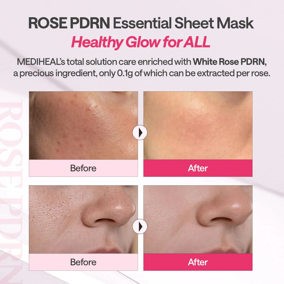 MEDIHEAL British White Rose PDRN Essential Mask Sheet Bio Emulsome 24ml × 11 sheets