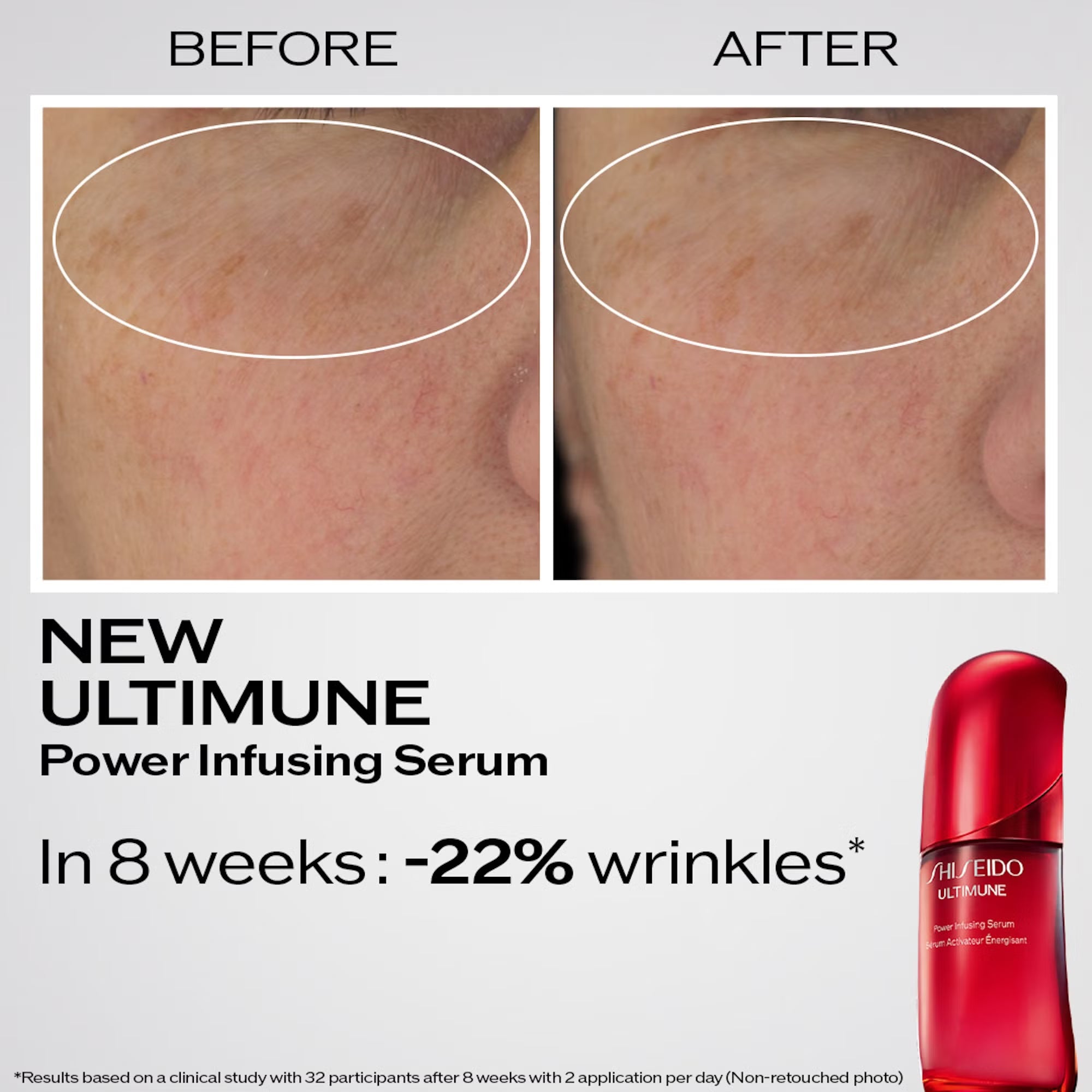 Shiseido Ultimune Power Infusing Serum 50ml